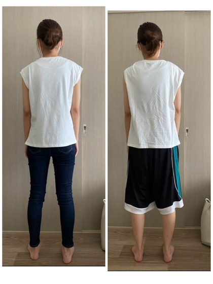 ストレートネックでしんどい
