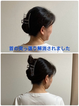スマホやパソコンでの首こりが解消
